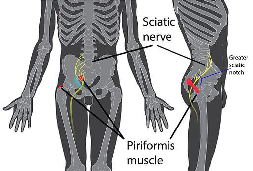 The Best Chair for Piriformis Syndrome