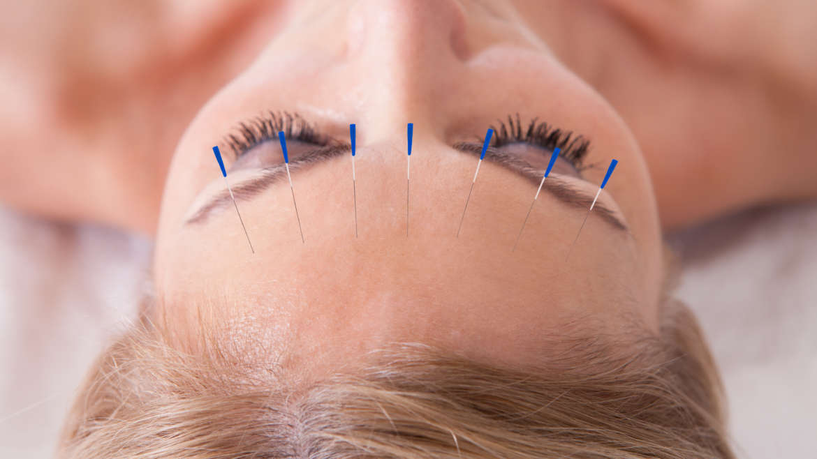 Facial Rejuvenation Acupuncture
