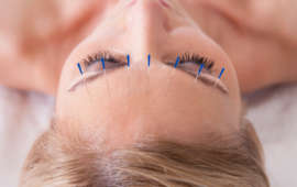 Facial Rejuvination Acupuncture in Brevard County, FL